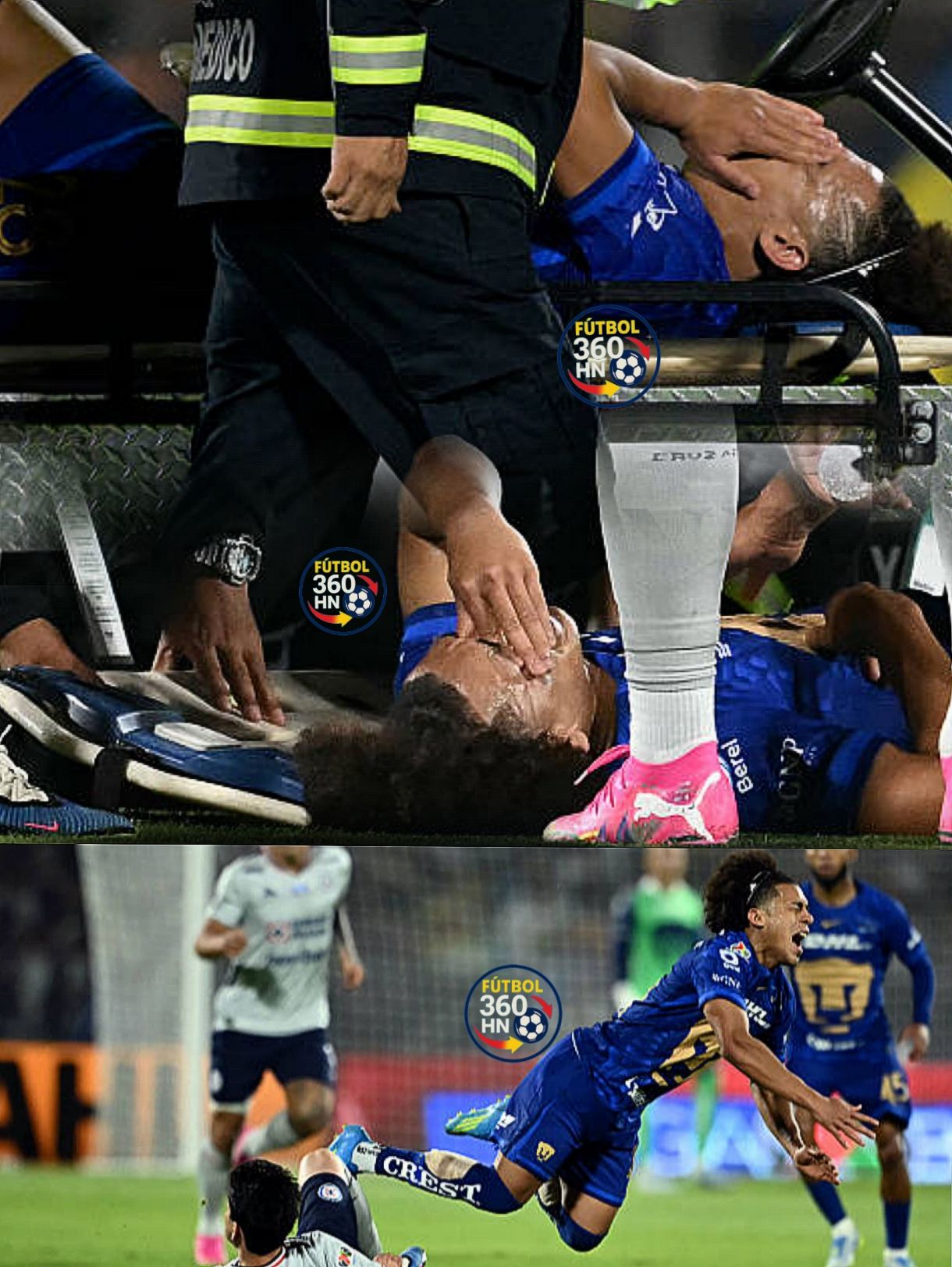 ¿Qué pasó con Coco Carrasquilla? Preocupación tras salir lesionado en la final Pumas vs Cruz Azul 💔🇵🇦 picsart 26 05 24 21 44 16 0757506537922663764001